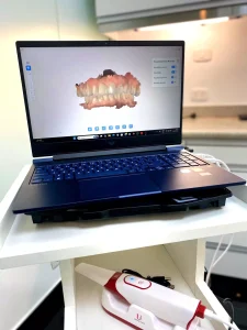 dental clinic scanner 3D
