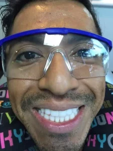 blanqueamiento dental caso real