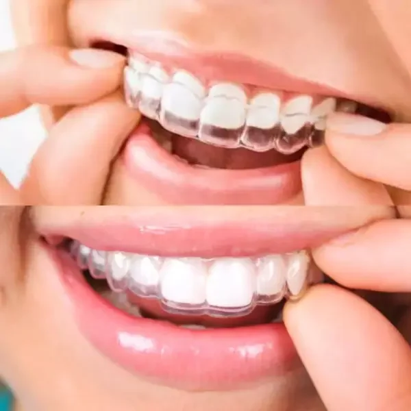 odontologia_cosmetica en Lima